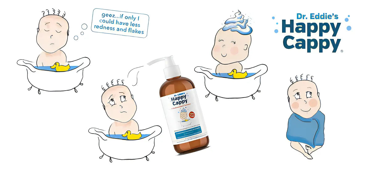 Shampoo Medicado Para Bebe Trata La Caspa Y Dermatitis 8oz