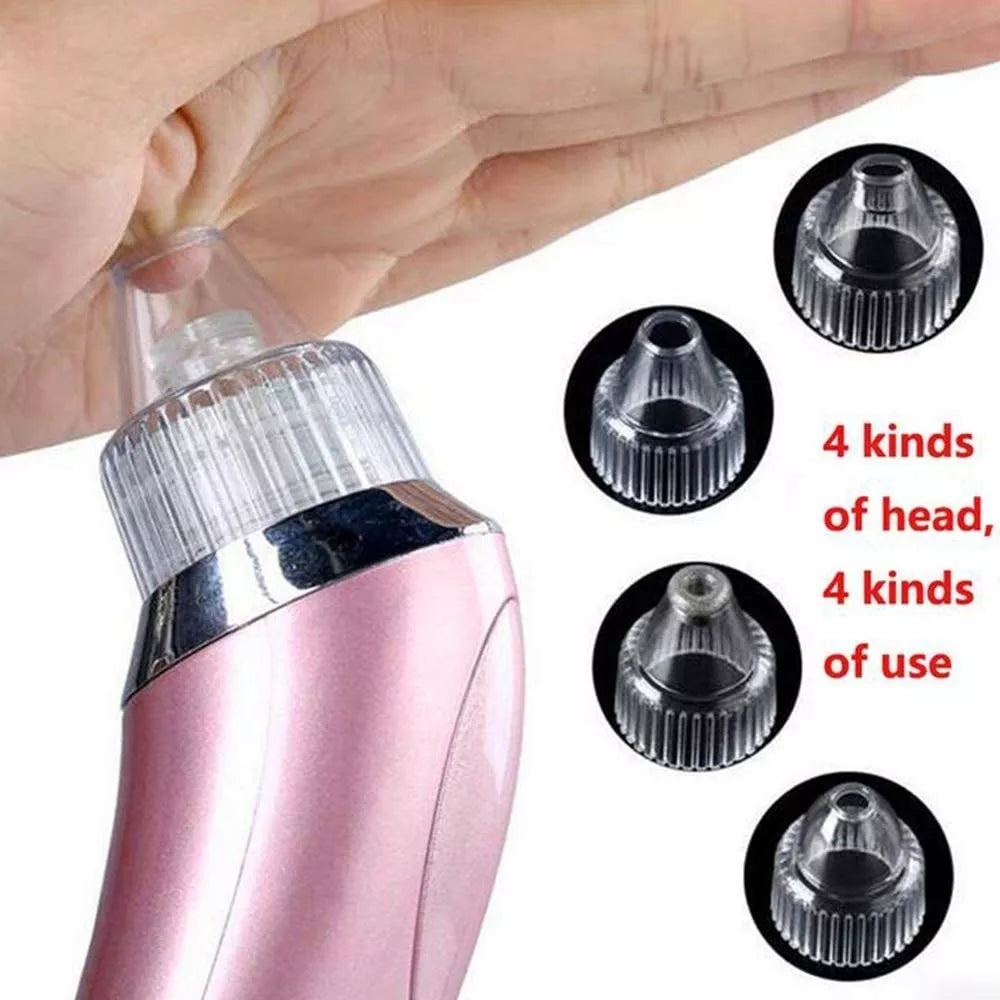 Extractor Facial De Espinillas Y Puntos Negros Eléctrico