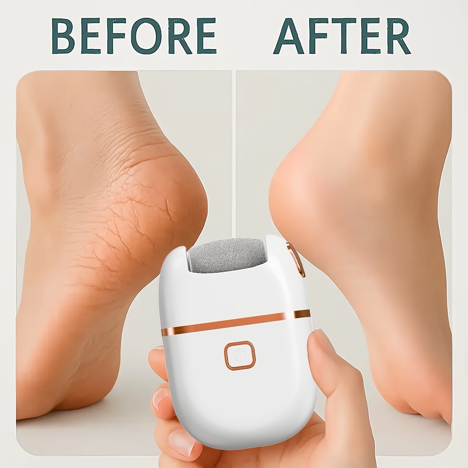 Lijadora eléctrica FEIYBA con 2 cabezales de lijado - Cargador USB, removida y luz muerta beige, diseño ergonómico para uso doméstico, herramienta de belleza para pies viajera para adultos y familia, removida de pies, rutina de cuidado de la piel, diseño