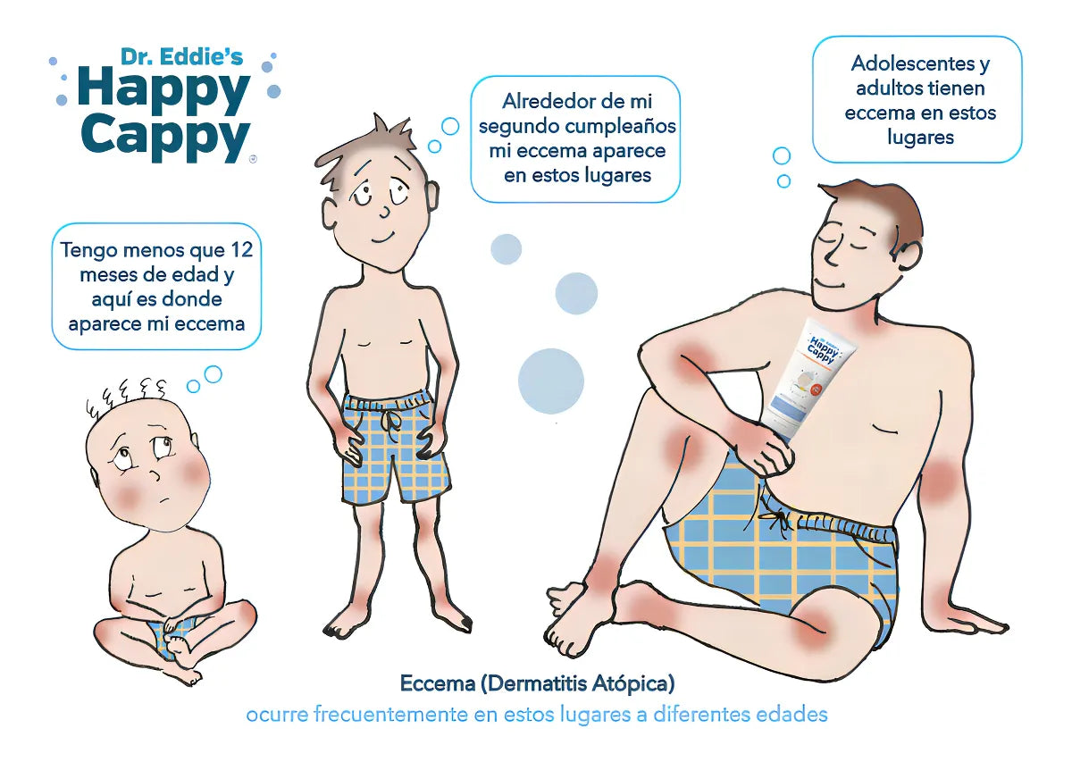 Shampoo Medicado Para Bebe Trata La Caspa Y Dermatitis 8oz