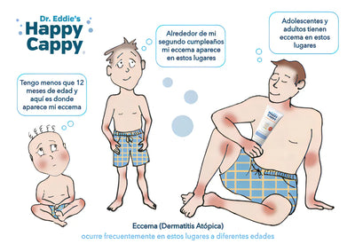 Shampoo Medicado Para Bebe Trata La Caspa Y Dermatitis 8oz