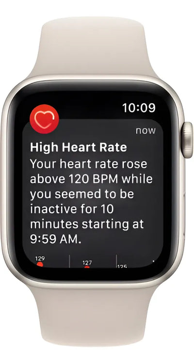 Apple Watch Se 2da Generacion 44mm Starlight Aluminum M/l