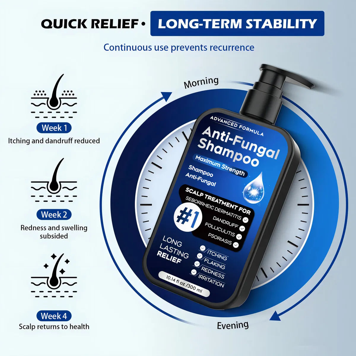 Champú Antifúngico Para Dermatitis Seborreica Y Caspa